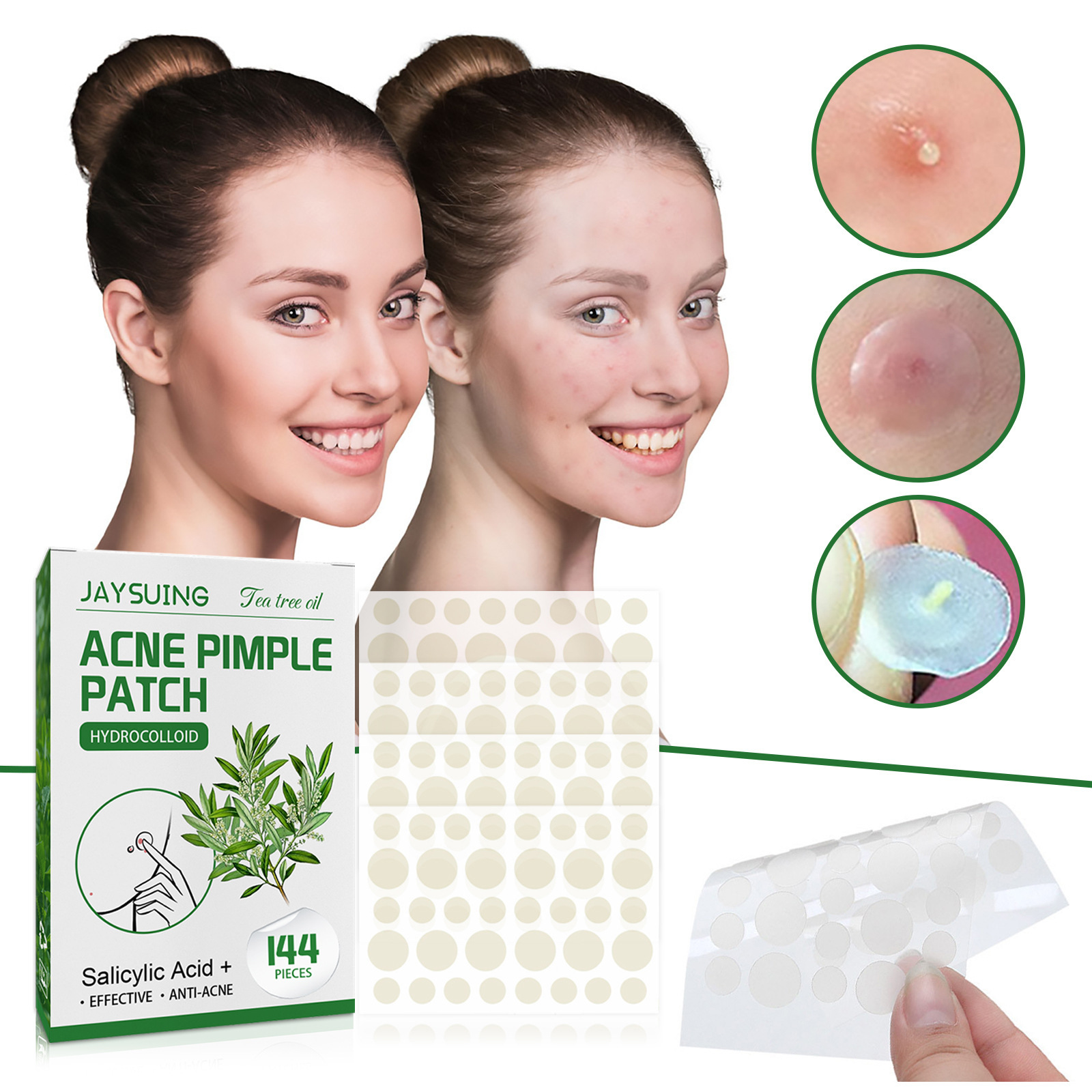 Hydrokolloid-Akne-Pflaster – a – Skincare The Originote Bewertung und Preis